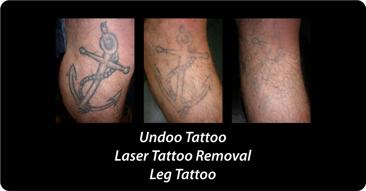 Undoo Tattoo tattoo work — photo 3
