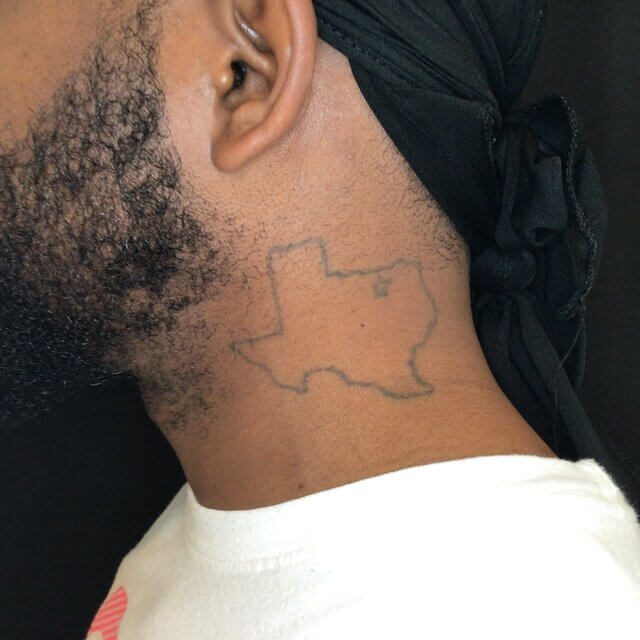 Removery Tattoo Removal & Fading — tattoo studio near Mesquite