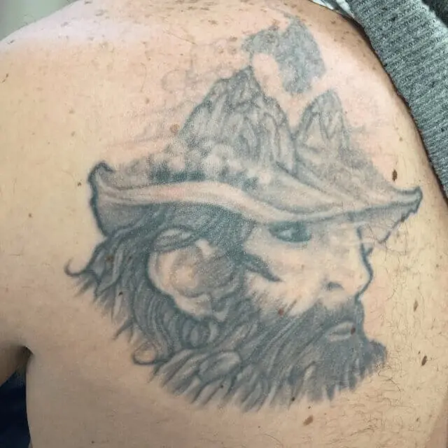 Removery Tattoo Removal & Fading — tattoo studio near Naperville