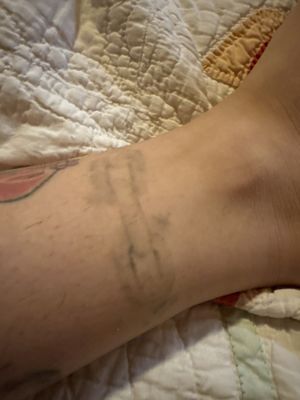 Removery Tattoo Removal & Fading — tattoo studio near Pasadena