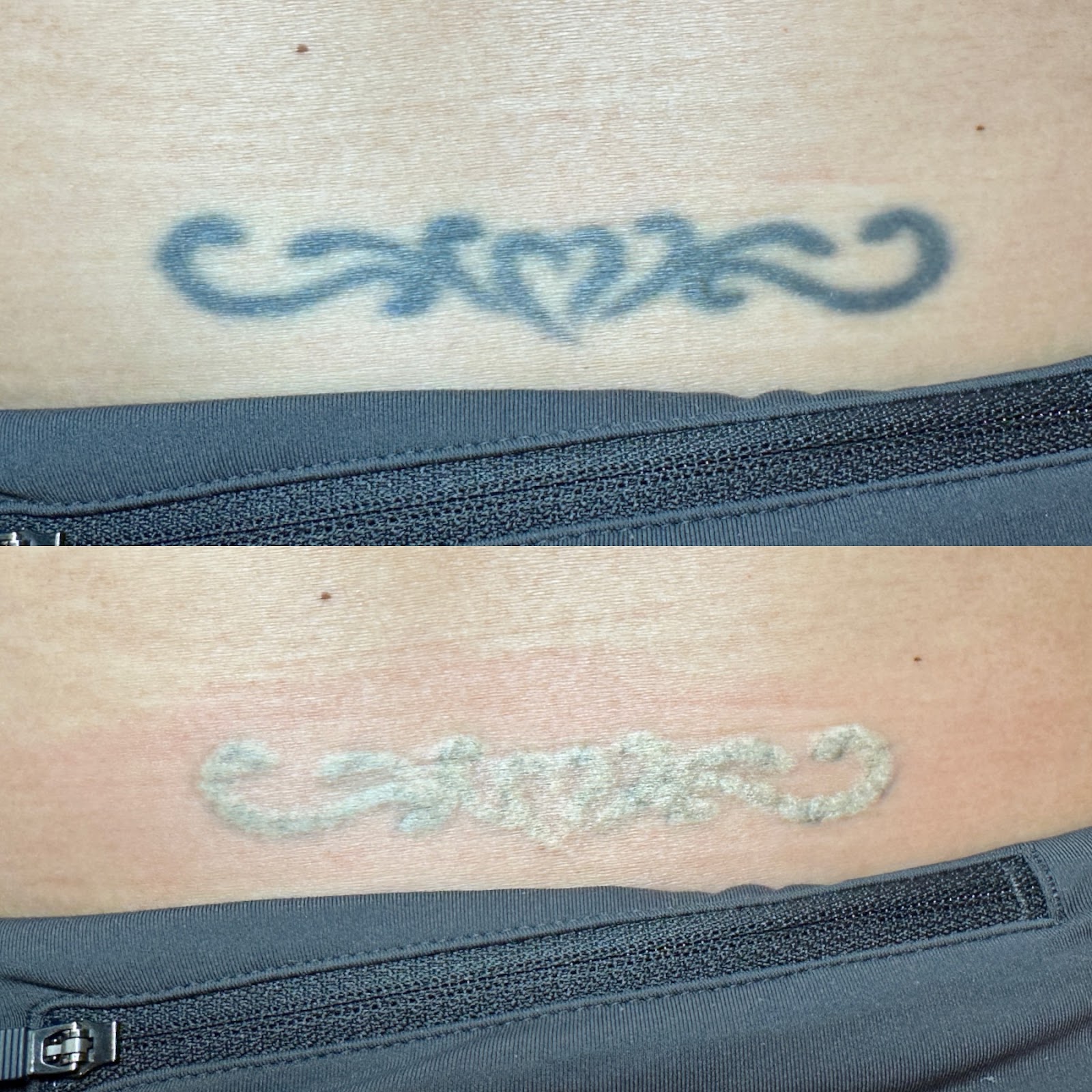 The Ink Eraser tattoo work — photo 2