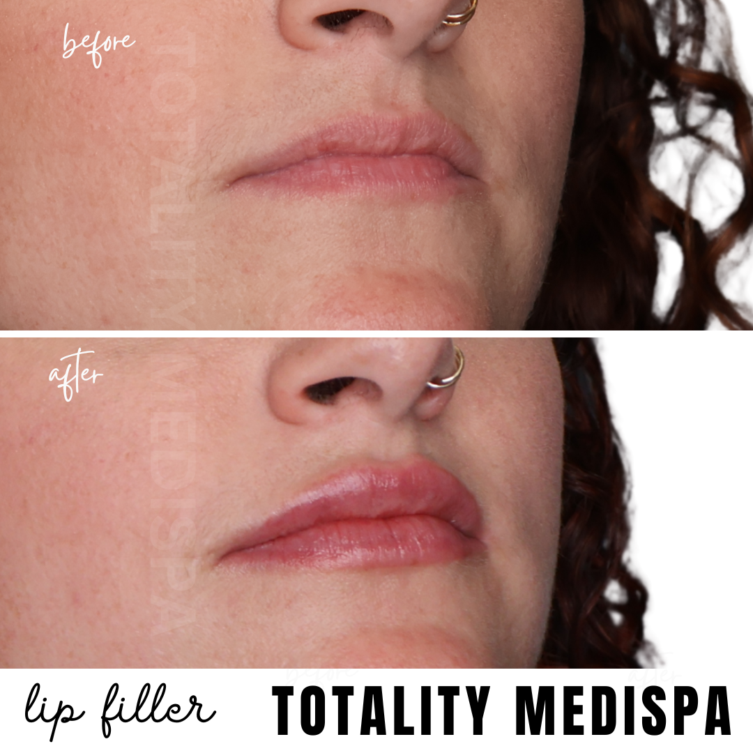 Totality Medispa — photo 2
