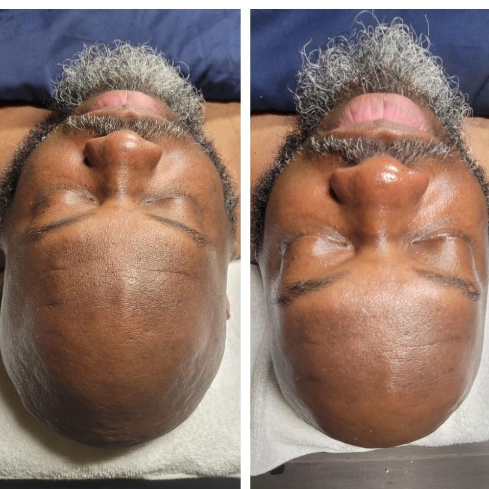 PURE WAX & BEAUTE BAR AESTHETICS/VIRTUAL SKINCARE — photo 3