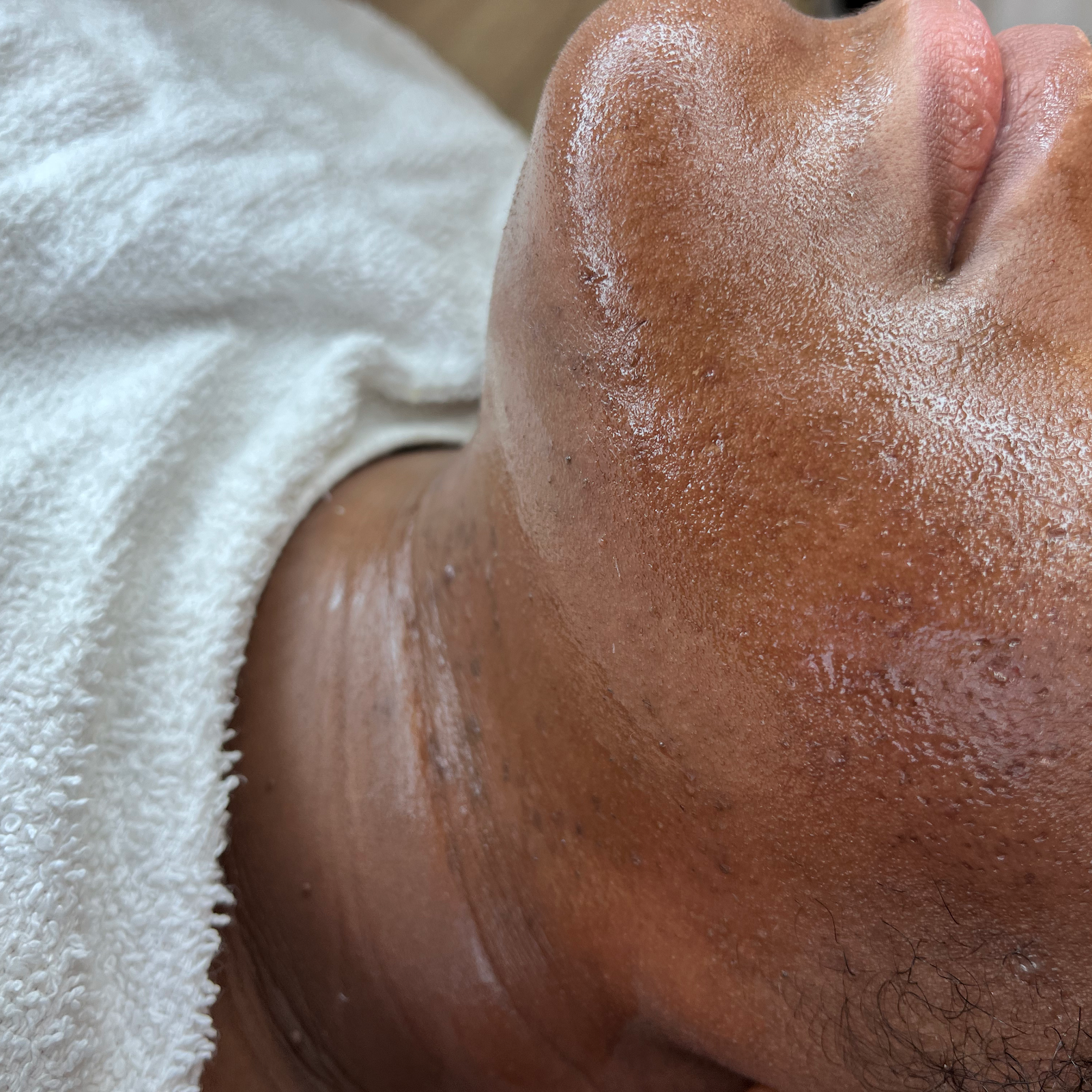 Gloei body sugaring — photo 3
