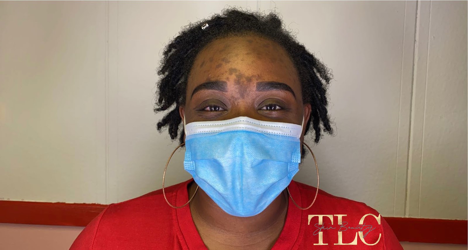 TLC Skin — photo 3