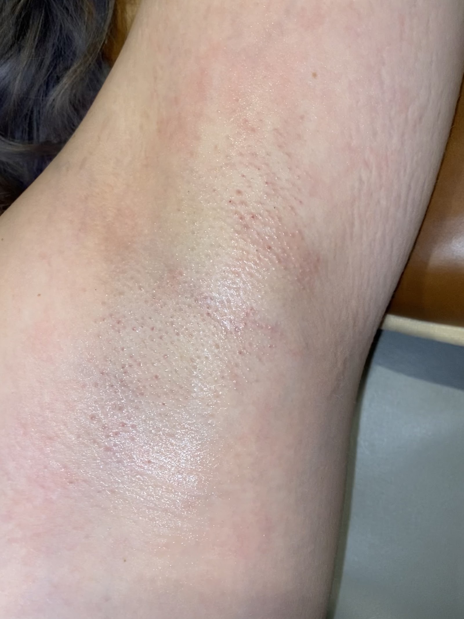 Polished Peach Esthetics — photo 2