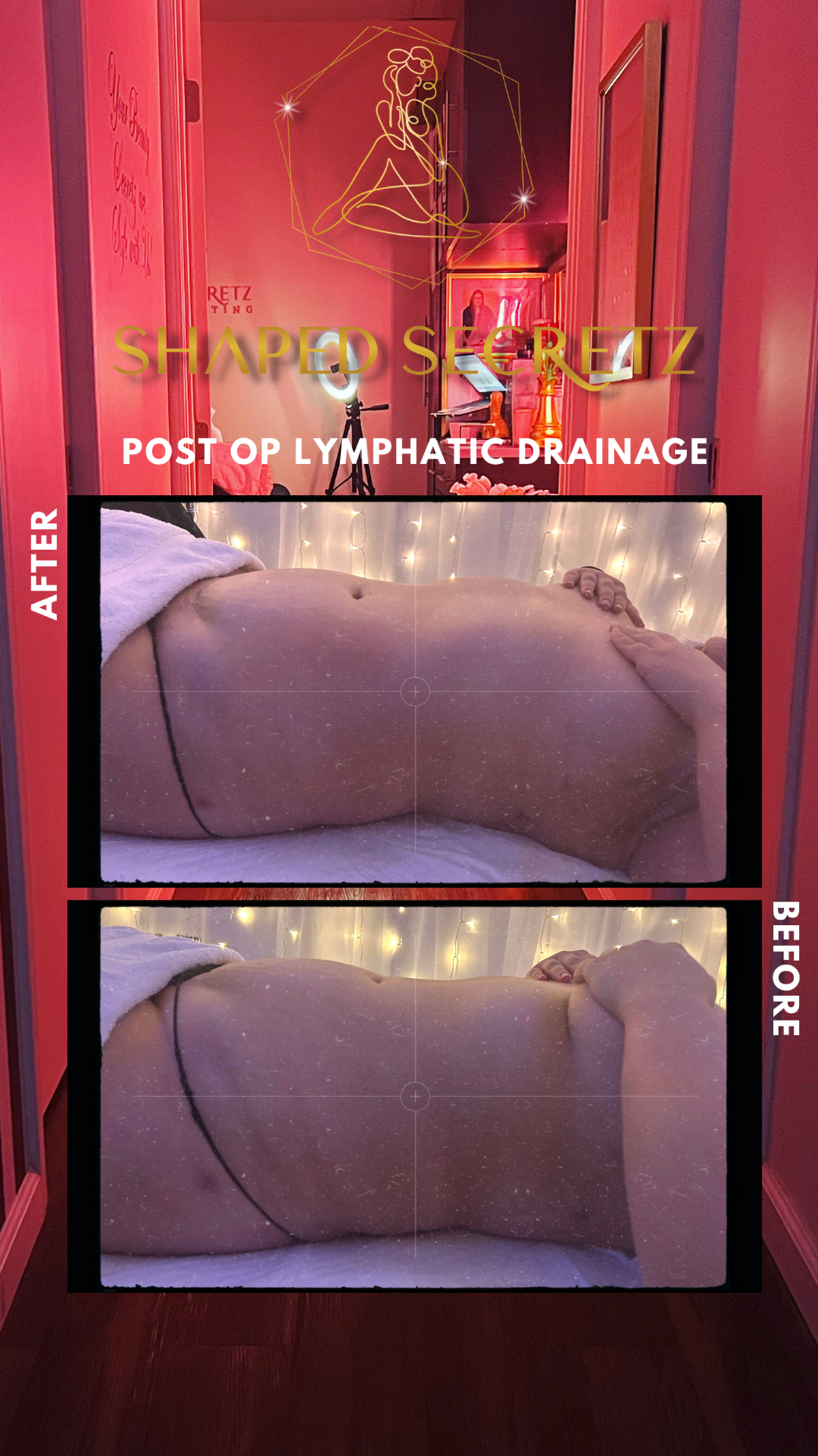 Shaped Secretz Body Sculpting — photo 3