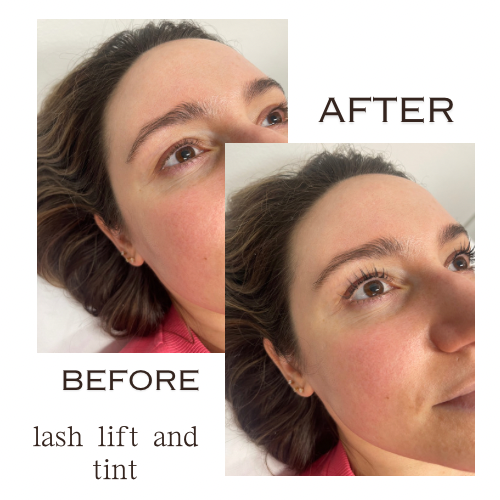 The Bare Bar Waxing — photo 3