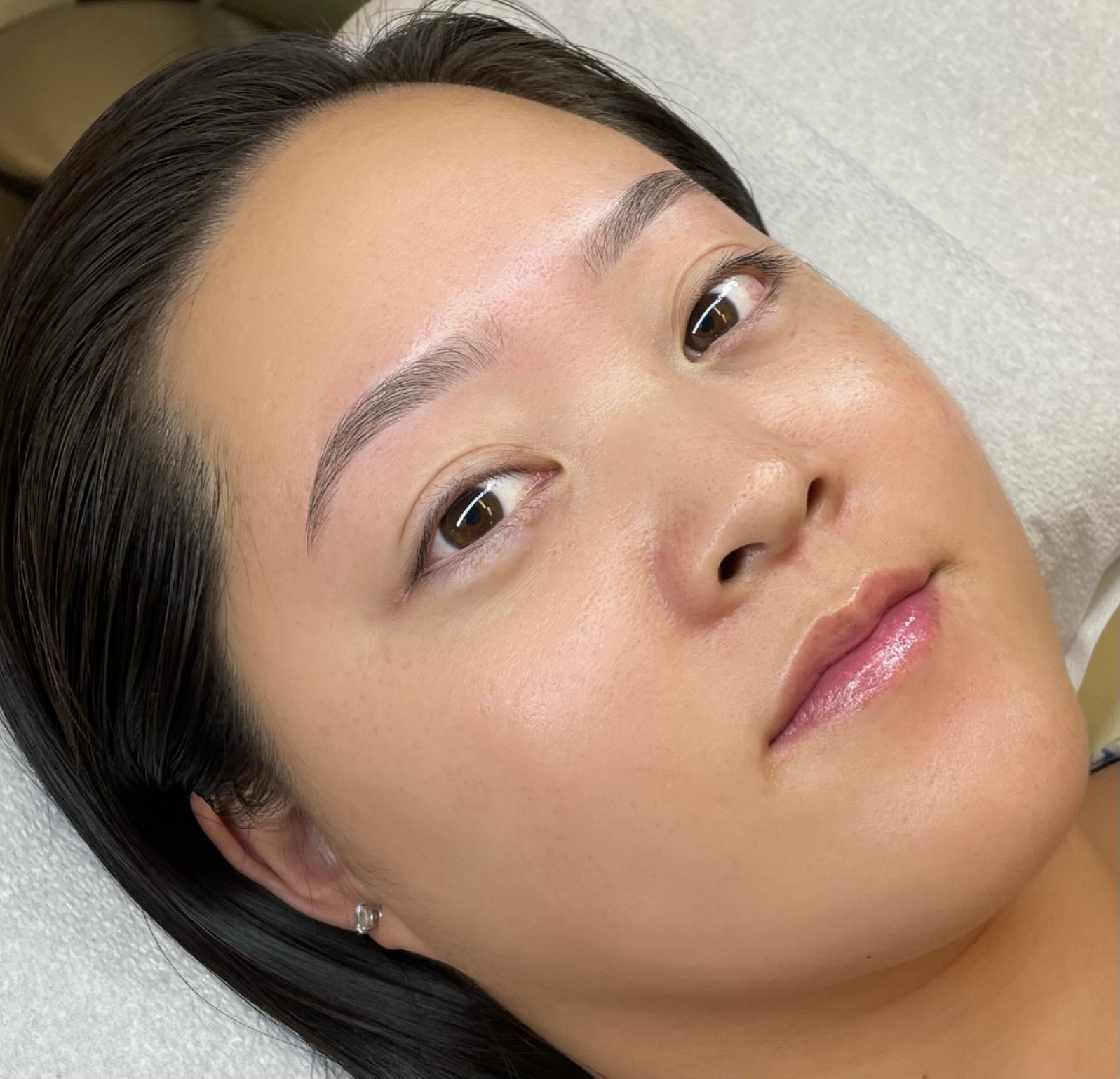 Dermabrow — photo 2