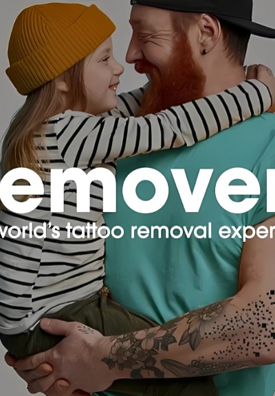 Removery Tattoo Removal & Fading in Cincinnati, OH