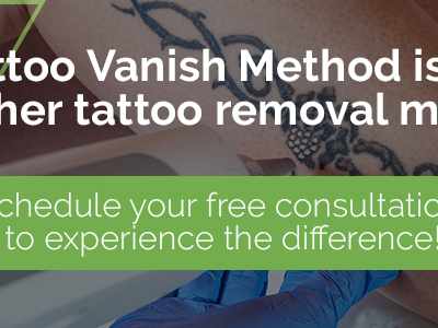 Tattoo Vanish in Bothell, WA