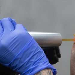 Removery Tattoo Removal & Fading in Matthews, NC