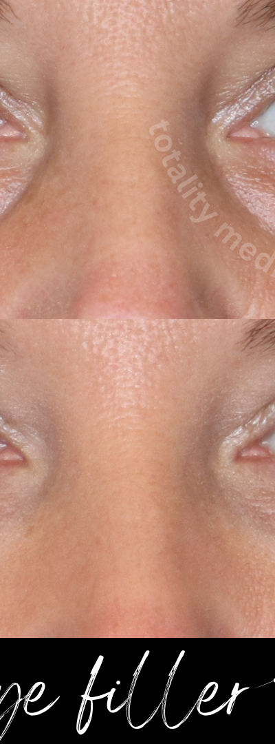 Totality Medispa in Charleston, SC