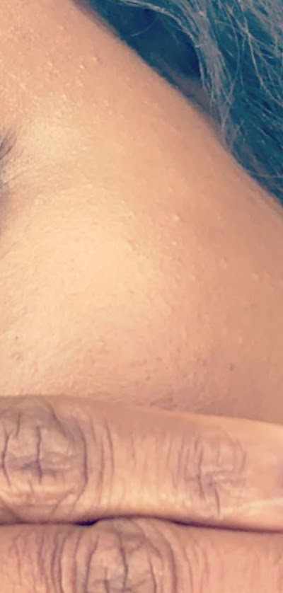 Brow Therapy in Cincinnati, OH