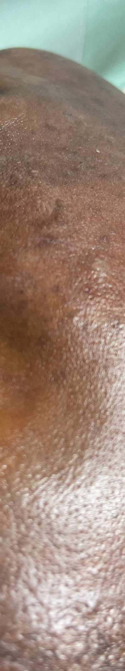 FACIALS BY VANESSA CT in Hartford, CT