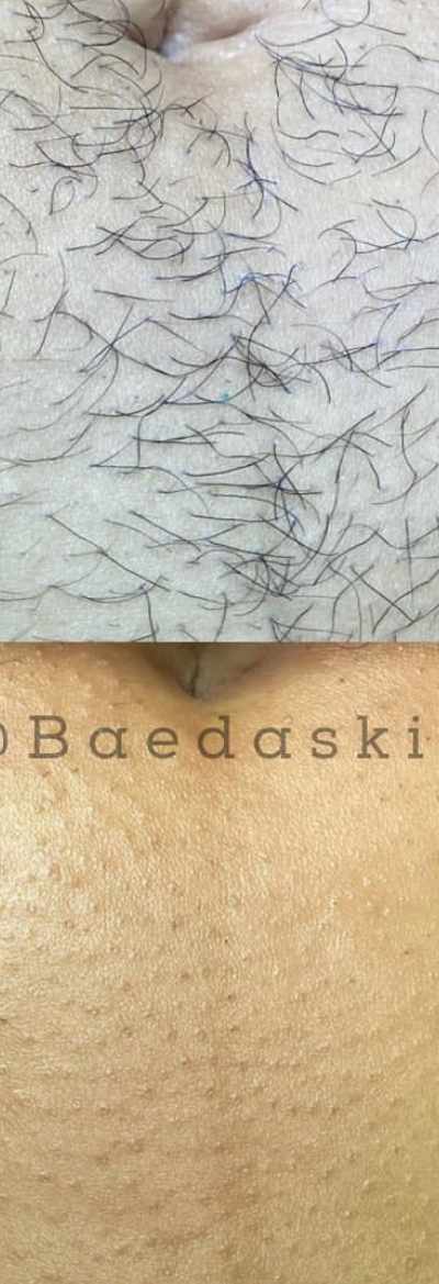 BaedaSkin Brazilian Waxing And Vajacials in Las Vegas, NV