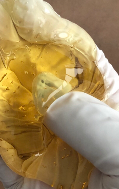 Silk Sugaring Hair Removal in Miami, FL
