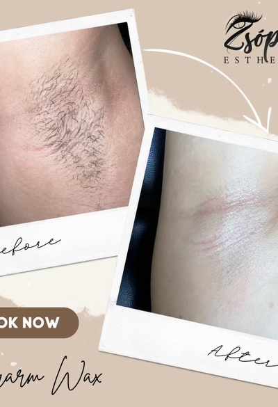 Zsophis Esthetics in Milwaukee, WI